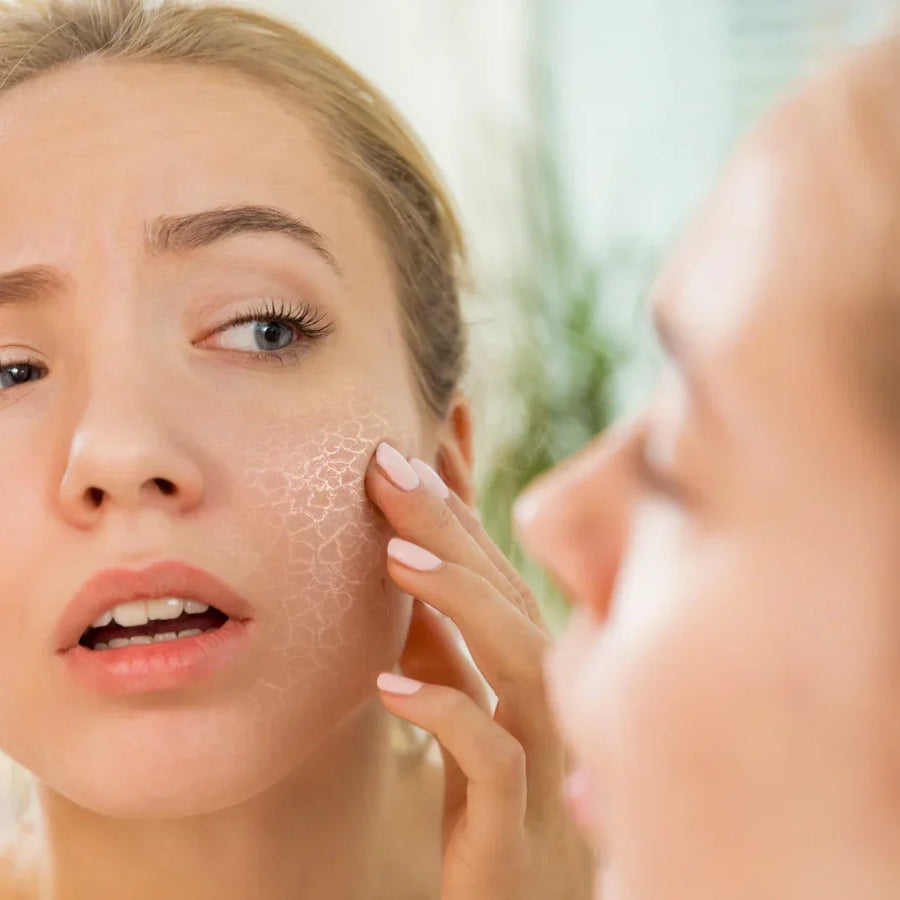Dry Skin During Ramadan: Causes and Tips for Soft, Radiant Skin